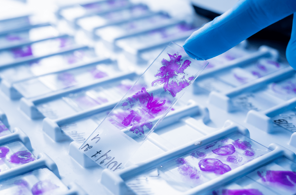 Hand in blue glove holding glass histology slides