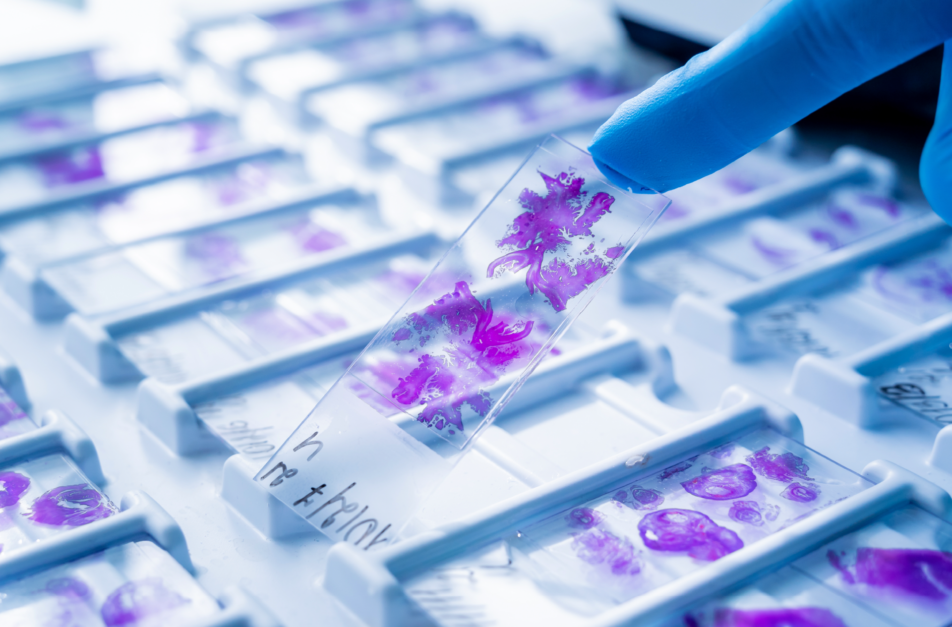 Hand in blue glove holding glass histology slides